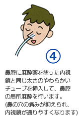 鼻腔に麻酔薬を塗った内視鏡と同じ太さのやわらかいチューブを挿入して、鼻腔の局所麻酔を行います。